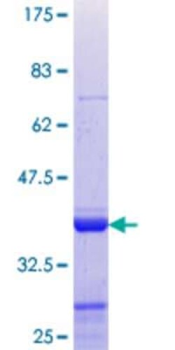 Novus Biologicals Recombinant Human Nab2 GST (N-Term) Protein 25 &mu;g | Buy Online | Novus Biologicals&trade; | Fisher Scientific