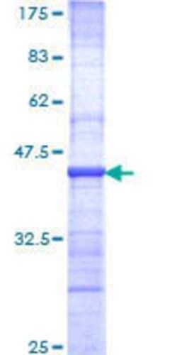 Novus Biologicals Recombinant Human Nbs1 GST (N-Term) Protein 10 &mu;g | Buy Online | Novus Biologicals&trade; | Fisher Scientific