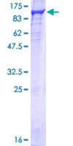 Novus Biologicals Recombinant Human NCBP1 GST (N-Term) Protein 10 &mu;g | Buy Online | Novus Biologicals&trade; | Fisher Scientific