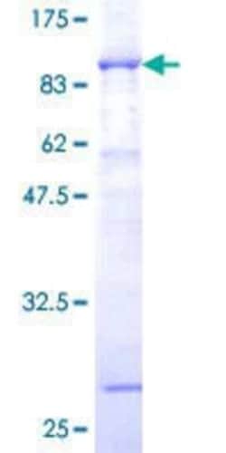 Novus Biologicals Recombinant Human p67phox/NOXA2 GST (N-Term) Protein 25 &mu;g | Buy Online | Novus Biologicals&trade; | Fisher Scientific