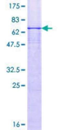 Novus Biologicals Recombinant Human Necdin GST (N-Term) Protein 25 &mu;g | Buy Online | Novus Biologicals&trade; | Fisher Scientific