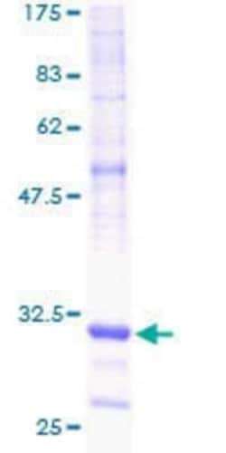 Novus Biologicals Recombinant Human NDUFA1 GST (N-Term) Protein 25 &mu;g | Buy Online | Novus Biologicals&trade; | Fisher Scientific