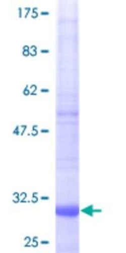Novus Biologicals Recombinant Human NDUFA1 GST (N-Term) Protein 10 &mu;g | Buy Online | Novus Biologicals&trade; | Fisher Scientific