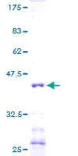 Novus Biologicals Recombinant Human NDUFA6 GST (N-Term) Protein 2 &mu;g | Buy Online | Novus Biologicals&trade; | Fisher Scientific