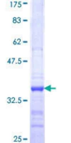 Novus Biologicals Recombinant Human NDUFA9 GST (N-Term) Protein 10 &mu;g | Buy Online | Novus Biologicals&trade; | Fisher Scientific
