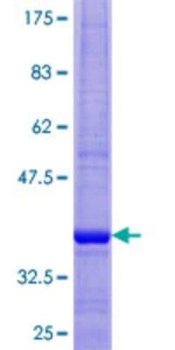 Novus Biologicals Recombinant Human NDUFB2 GST (N-Term) Protein 10 &mu;g | Buy Online | Novus Biologicals&trade; | Fisher Scientific