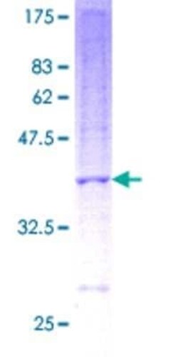 Novus Biologicals Recombinant Human NDUFB3 GST (N-Term) Protein 2 &mu;g | Buy Online | Novus Biologicals&trade; | Fisher Scientific