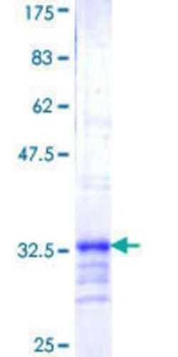 Novus Biologicals Recombinant Human NDUFB3 GST (N-Term) Protein 25 &mu;g | Buy Online | Novus Biologicals&trade; | Fisher Scientific
