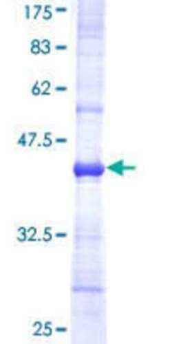 Novus Biologicals Recombinant Human NDUFB5 GST (N-Term) Protein 25 &mu;g | Buy Online | Novus Biologicals&trade; | Fisher Scientific