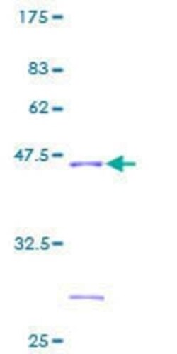 Novus Biologicals Recombinant Human NDUFB6 GST (N-Term) Protein 10 &mu;g | Buy Online | Novus Biologicals&trade; | Fisher Scientific