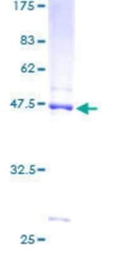 Novus Biologicals Recombinant Human NDUFB8 GST (N-Term) Protein 10 &mu;g | Buy Online | Novus Biologicals&trade; | Fisher Scientific