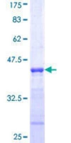 Novus Biologicals Recombinant Human NDUFB10 GST (N-Term) Protein 10 &mu;g | Buy Online | Novus Biologicals&trade; | Fisher Scientific