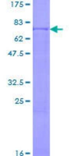 Novus Biologicals Recombinant Human NDUFV1 GST (N-Term) Protein 2 &mu;g | Buy Online | Novus Biologicals&trade; | Fisher Scientific