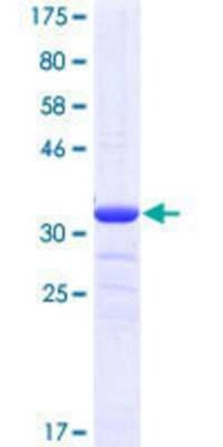 Novus Biologicals Recombinant Human NDUFV1 GST (N-Term) Protein 25 &mu;g | Buy Online | Novus Biologicals&trade; | Fisher Scientific