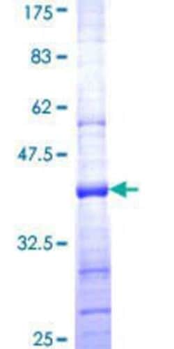Novus Biologicals Recombinant Human NDUFS8 GST (N-Term) Protein 10 &mu;g | Buy Online | Novus Biologicals&trade; | Fisher Scientific