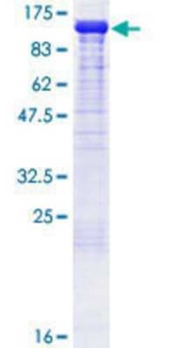 Novus Biologicals Recombinant Human NEDD9/CASL/HEF1 GST (N-Term) Protein 25 &mu;g | Buy Online | Novus Biologicals&trade; | Fisher Scientific