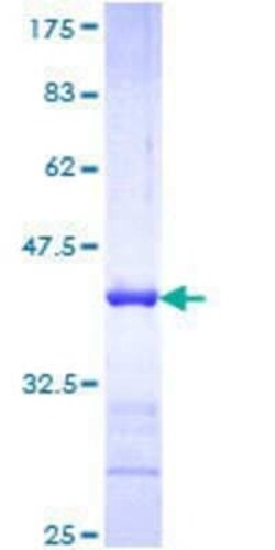 Novus Biologicals Recombinant Human NF-H GST (N-Term) Protein 25 &mu;g | Buy Online | Novus Biologicals&trade; | Fisher Scientific