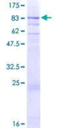 Novus Biologicals Recombinant Human NEK3 GST (N-Term) Protein 25 &mu;g | Buy Online | Novus Biologicals&trade; | Fisher Scientific