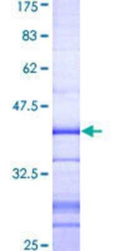 Novus Biologicals Recombinant Human NEK3 GST (N-Term) Protein 10 &mu;g | Buy Online | Novus Biologicals&trade; | Fisher Scientific