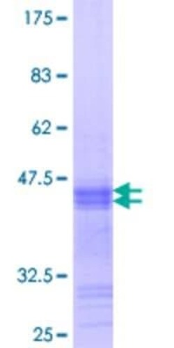 Novus Biologicals Recombinant Human NeuroD2 GST (N-Term) Protein 25 &mu;g | Buy Online | Novus Biologicals&trade; | Fisher Scientific