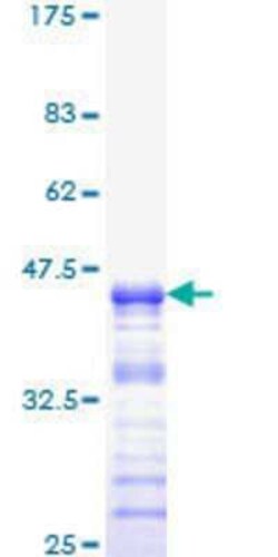 Novus Biologicals&trade;&nbsp;Recombinant Human Neurofibromin 1 GST (N-Term) Protein