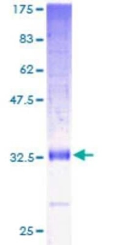 Novus Biologicals Recombinant Human NF2/Merlin GST (N-Term) Protein 2 &mu;g | Buy Online | Novus Biologicals&trade; | Fisher Scientific