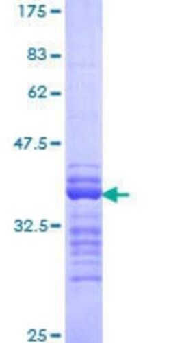 Novus Biologicals Recombinant Human NFATC3/NFAT4 GST (N-Term) Protein 25 &mu;g | Buy Online | Novus Biologicals&trade; | Fisher Scientific