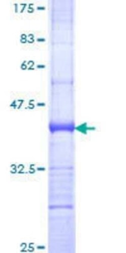 Novus Biologicals Recombinant Human NFATC4 GST (N-Term) Protein 25 &mu;g | Buy Online | Novus Biologicals&trade; | Fisher Scientific