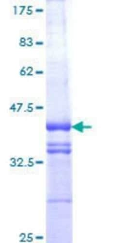 Novus Biologicals Recombinant Human Nuclear Factor Erythroid 2 Related Factor 1 GST (N-Term) Protein 10 &mu;g | Buy Online | Novus Biologicals&trade; | Fisher Scientific