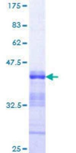 Novus Biologicals Recombinant Human NFIC GST (N-Term) Protein 10 &mu;g | Buy Online | Novus Biologicals&trade; | Fisher Scientific