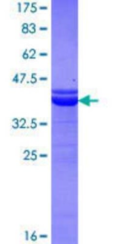 Novus Biologicals Recombinant Human NFIX GST (N-Term) Protein 25 &mu;g | Buy Online | Novus Biologicals&trade; | Fisher Scientific