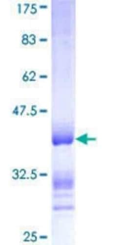 Novus Biologicals Recombinant Human IkB-epsilon GST (N-Term) Protein 10 &mu;g | Buy Online | Novus Biologicals&trade; | Fisher Scientific