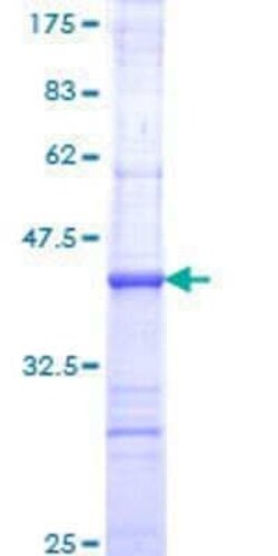 Novus Biologicals Recombinant Human NFKBIL2 GST (N-Term) Protein 25 &mu;g | Buy Online | Novus Biologicals&trade; | Fisher Scientific