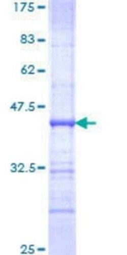 Novus Biologicals Recombinant Human NFRKB GST (N-Term) Protein 2 &mu;g | Buy Online | Novus Biologicals&trade; | Fisher Scientific