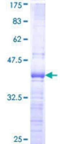 Novus Biologicals Recombinant Human NFYA GST (N-Term) Protein 10 &mu;g | Buy Online | Novus Biologicals&trade; | Fisher Scientific