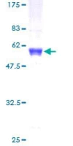 Novus Biologicals Recombinant Human NFYB GST (N-Term) Protein 10 &mu;g | Buy Online | Novus Biologicals&trade; | Fisher Scientific