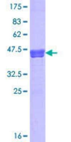 Novus Biologicals Recombinant Human NHS GST (N-Term) Protein 25 &mu;g | Buy Online | Novus Biologicals&trade; | Fisher Scientific