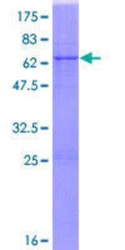 Novus Biologicals Recombinant Human Nitrilase 1 GST (N-Term) Protein 25 &mu;g | Buy Online | Novus Biologicals&trade; | Fisher Scientific