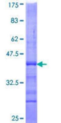 Novus Biologicals Recombinant Human NKX2.2 GST (N-Term) Protein 2 &mu;g | Buy Online | Novus Biologicals&trade; | Fisher Scientific