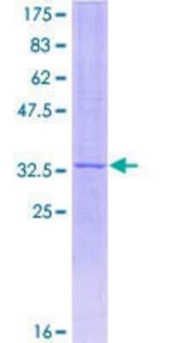 Novus Biologicals Recombinant Human Neuronatin GST (N-Term) Protein 10 &mu;g | Buy Online | Novus Biologicals&trade; | Fisher Scientific