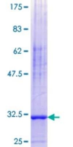 Novus Biologicals Recombinant Human Neuronatin GST (N-Term) Protein 25 &mu;g | Buy Online | Novus Biologicals&trade; | Fisher Scientific