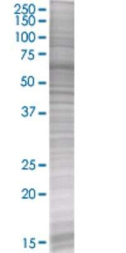 Novus Biologicals NME3 293T Cell Transient Overexpression Lysate 0,1 mL | Buy Online | Novus Biologicals&trade; | Fisher Scientific