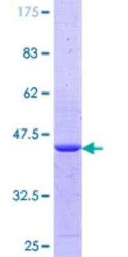 Novus Biologicals Recombinant Human NONO GST (N-Term) Protein 10 &mu;g | Buy Online | Novus Biologicals&trade; | Fisher Scientific