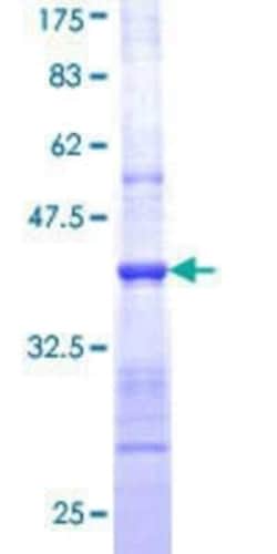 Novus Biologicals Recombinant Human nNOS GST (N-Term) Protein 25 &mu;g | Buy Online | Novus Biologicals&trade; | Fisher Scientific