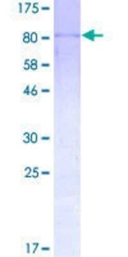 Novus Biologicals Recombinant Human CNOT2 GST (N-Term) Protein 10 &mu;g | Buy Online | Novus Biologicals&trade; | Fisher Scientific