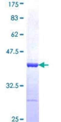 Novus Biologicals Recombinant Human CNOT2 GST (N-Term) Protein 10 &mu;g | Buy Online | Novus Biologicals&trade; | Fisher Scientific