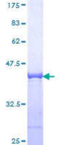 Novus Biologicals Recombinant Human CNOT3 GST (N-Term) Protein 25 &mu;g | Buy Online | Novus Biologicals&trade; | Fisher Scientific