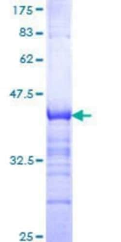 Novus Biologicals Recombinant Human NPAS2 GST (N-Term) Protein 25 &mu;g | Buy Online | Novus Biologicals&trade; | Fisher Scientific