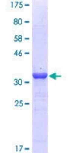 Novus Biologicals Recombinant Human Niemann-Pick C1 GST (N-Term) Protein 10 &mu;g | Buy Online | Novus Biologicals&trade; | Fisher Scientific