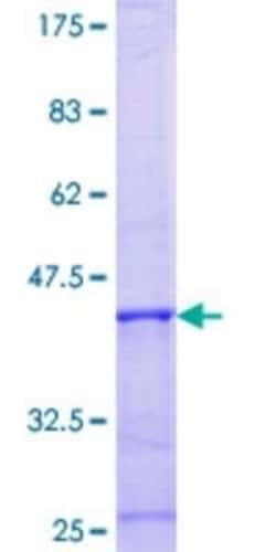Novus Biologicals Recombinant Human Nephronophthisis GST (N-Term) Protein 10 &mu;g | Buy Online | Novus Biologicals&trade; | Fisher Scientific